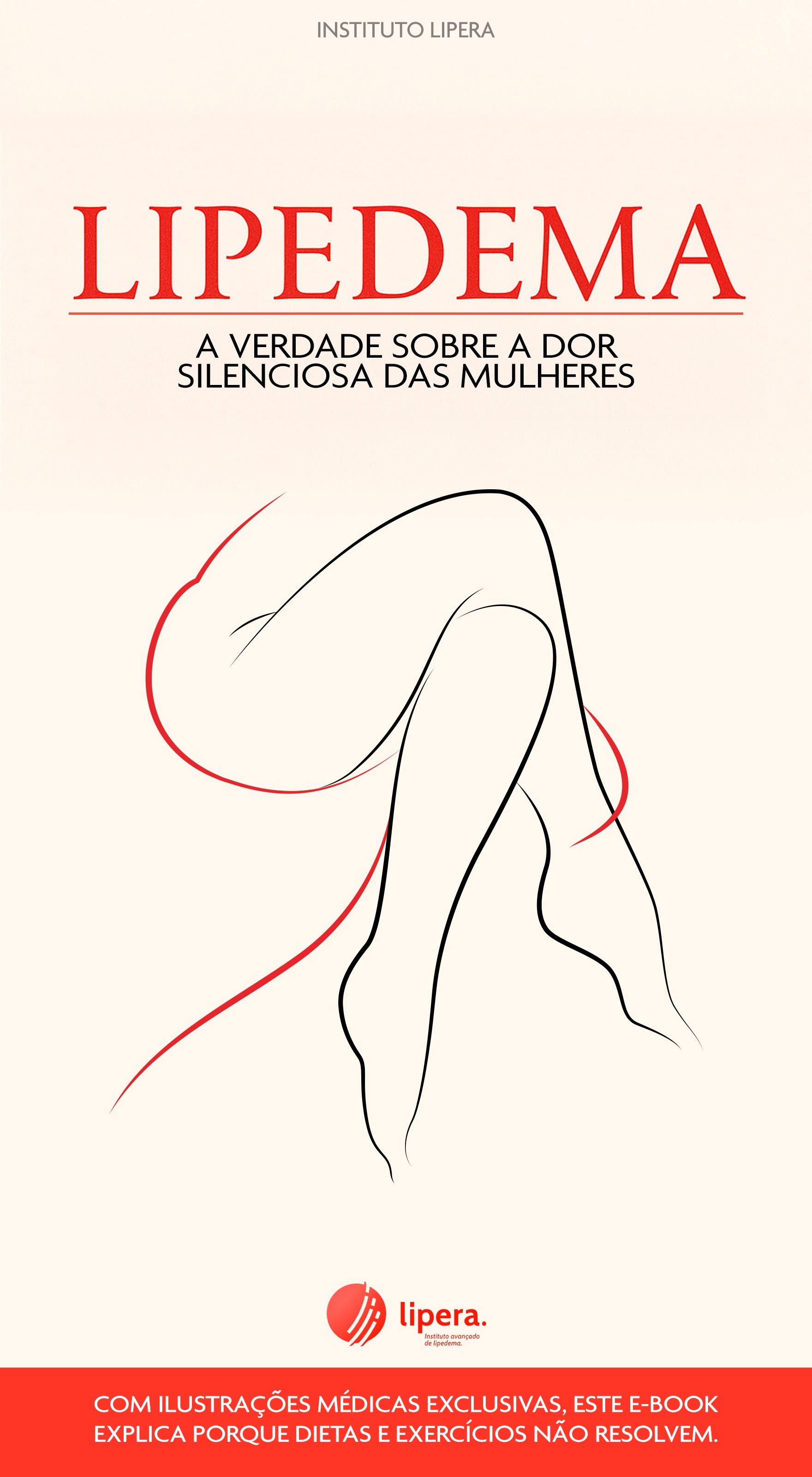 Capa do e-book Lipedema: a verdade sobre a dor silenciosa das mulheres